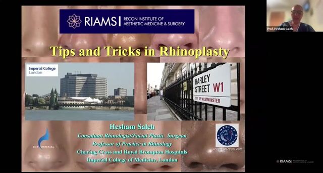 Tips & Tricks in Rhinoplasty