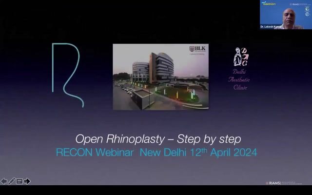Steps of Open Rhinoplasty